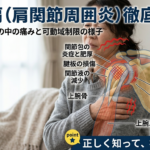 肩関節周囲炎による肩の痛みと腕の動かしにくさのイメージ