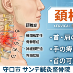 頸椎症による首の痛みや肩こり、手のしびれのイメージ