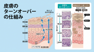 美容鍼によるターンオーバーの仕組み